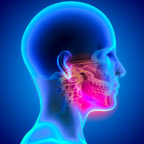 Temporomandibular Joint Disorder (TMJ)