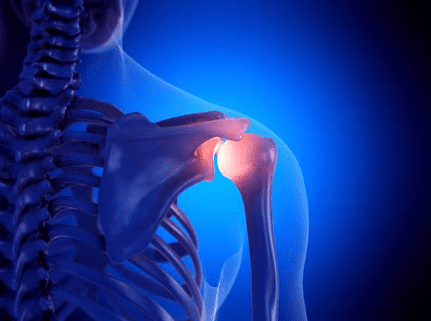 Physical Therapy for a Torn Rotator Cuff
