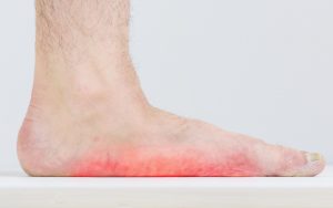 Get relief with Physical therapy for Flat Feet