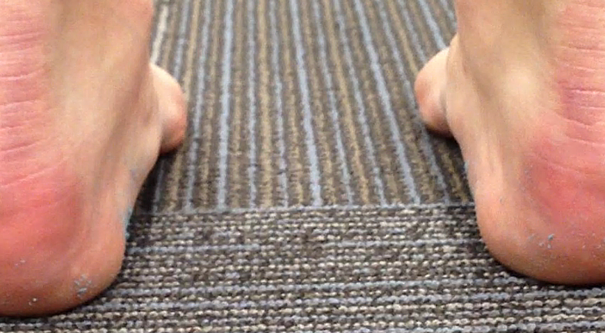 achilles-tendinitis-2