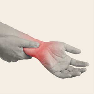 carpal-tunnel-syndrome-2